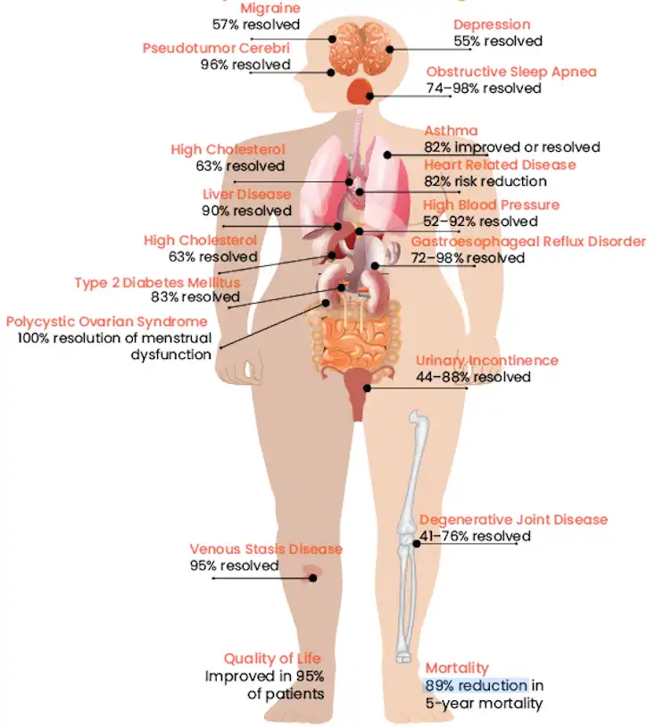 WeightLoss_image