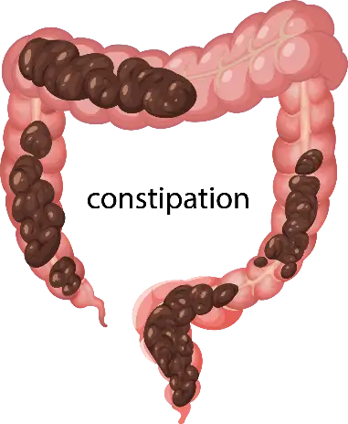 Can Gout Lead to Kidney Stone Formation5