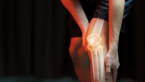 Knee Pain 5