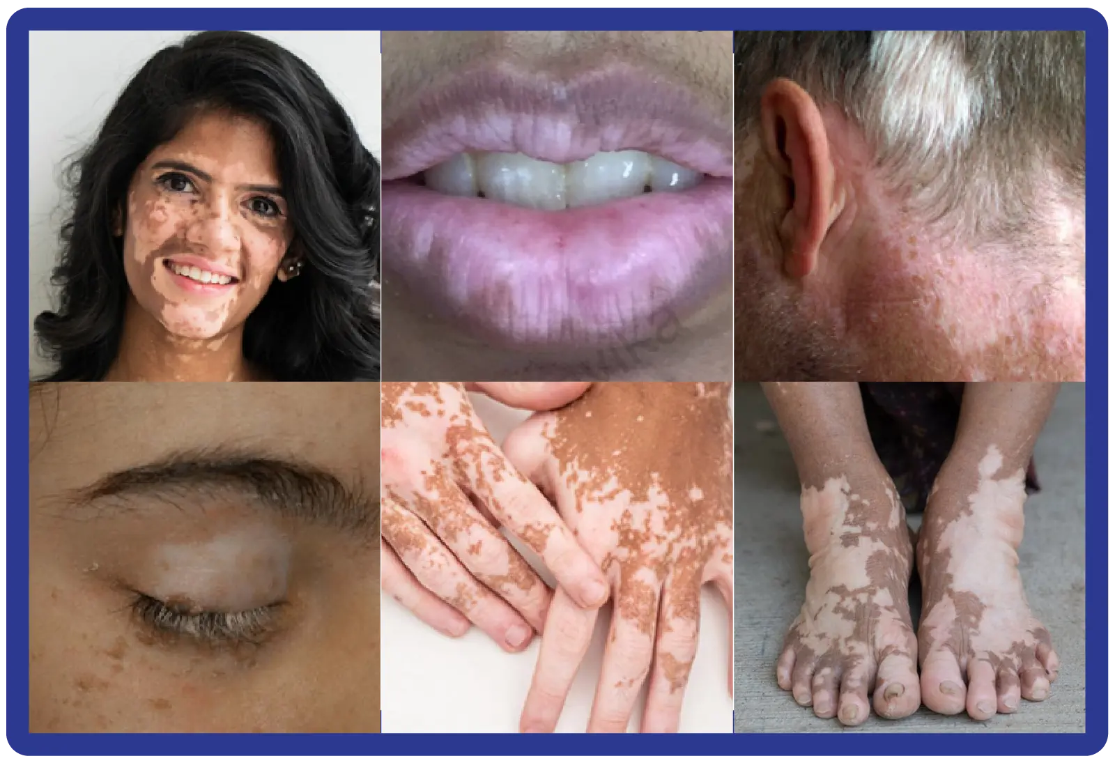 Loss of Skin Color