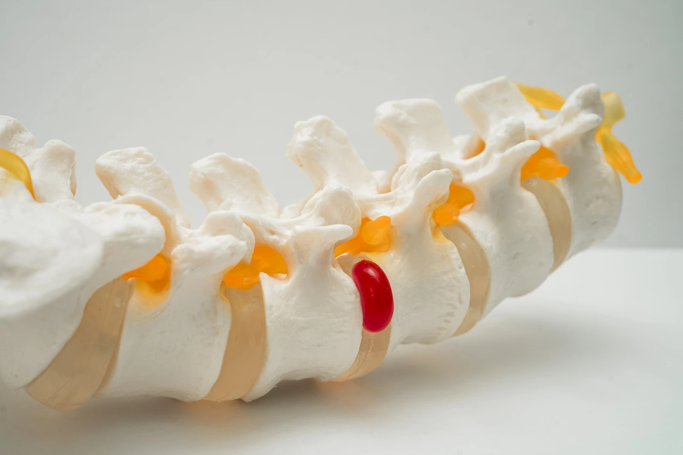 slipped disc