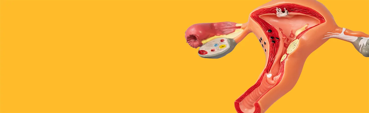 pap smear and hpv self-test