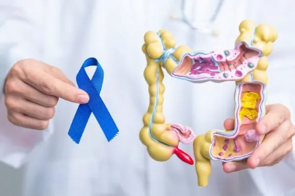 12-HealthPulse-Can Colorectal Cancer Occur in Young Adults