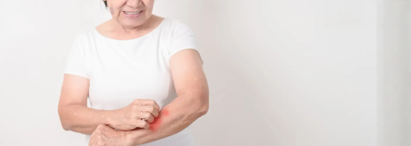 Is Shinges Contagious