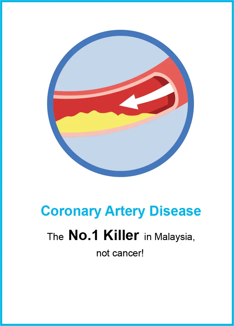 Coronary Artery Disease