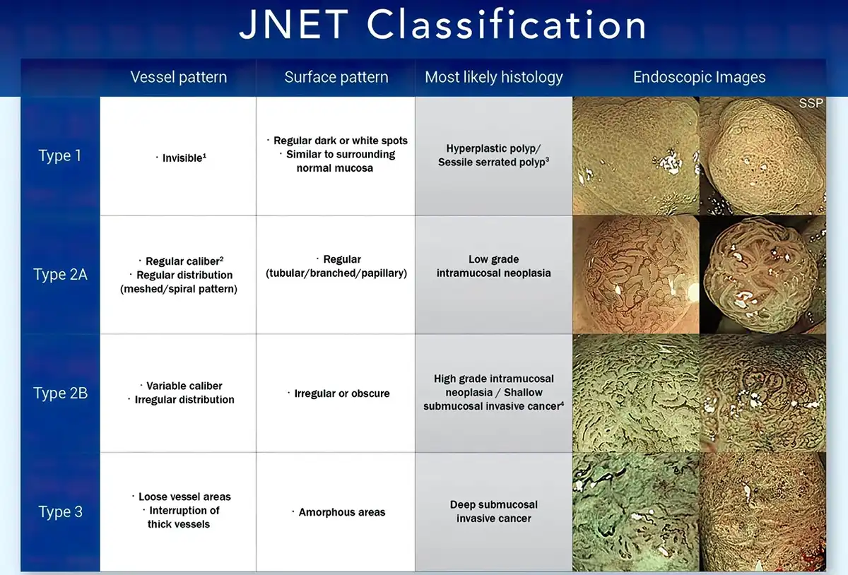 Standardized classification.1 image