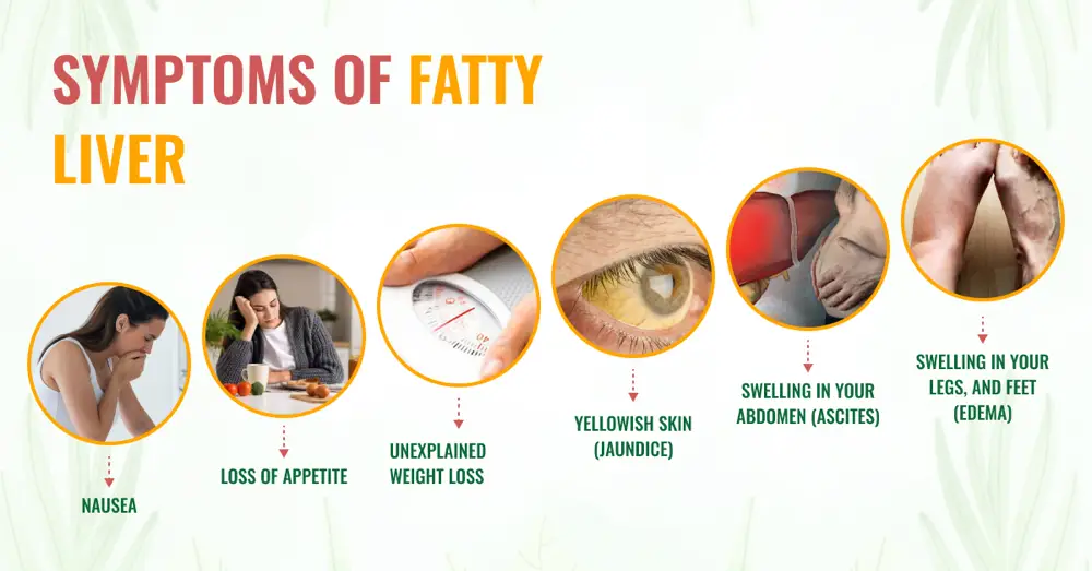 UNDERSTANDING FATTY LIVER DISEASE Pantai Hospital Penang UNDERSTANDING FATTY LIVER DISEASE Pantai Hospital Penang